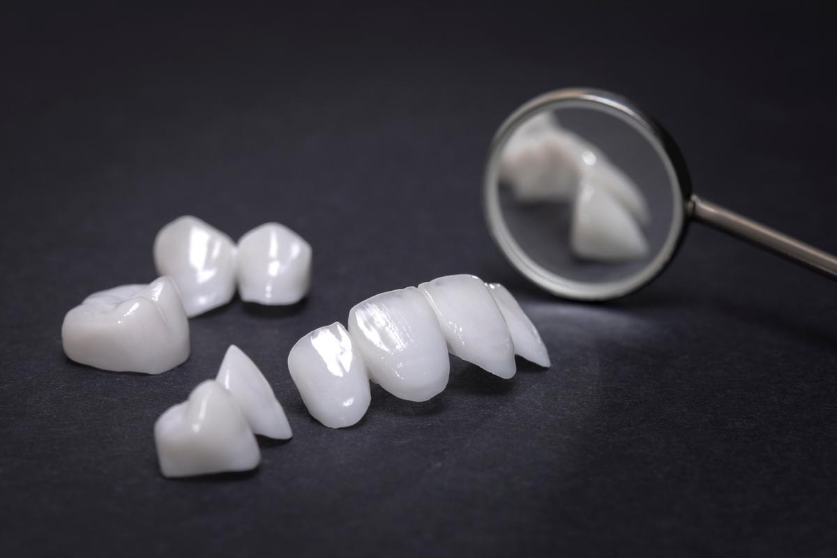南京牙齿矫正贴片价格揭秘：不同材质与方案费用详解