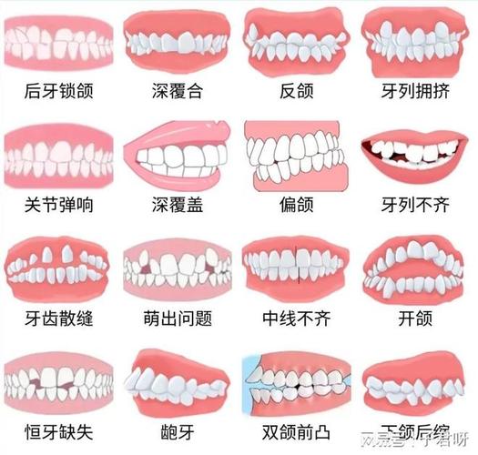 南京儿童牙齿矫正一般价格多少?带娃整牙到底花几万