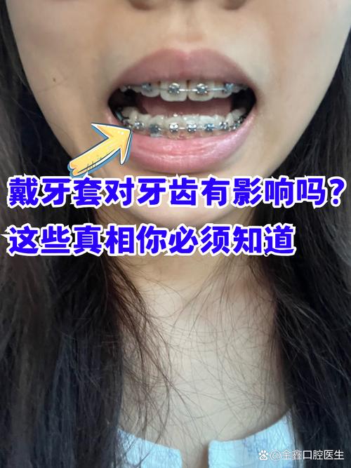 南京成人矫正牙齿口腔值得做吗 这些真相医生不会主动说
