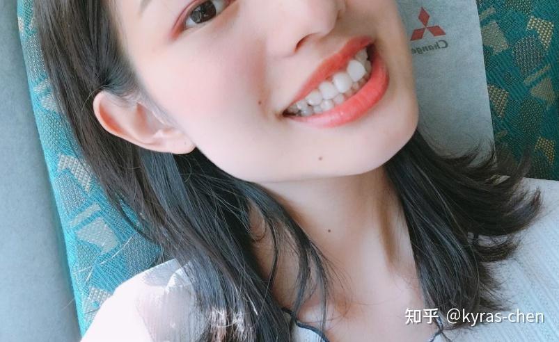 南京成人门牙不齐矫正真的很简单吗