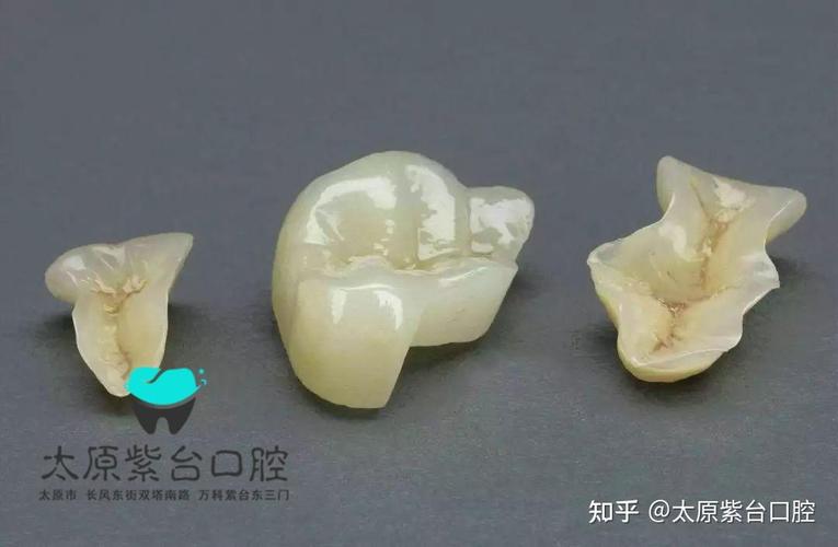 南京口腔检查反馈单看不懂?3步教你秒读