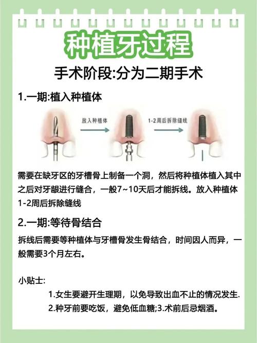 南京种牙不是埋种子等发芽 手术过程疼不疼要多久