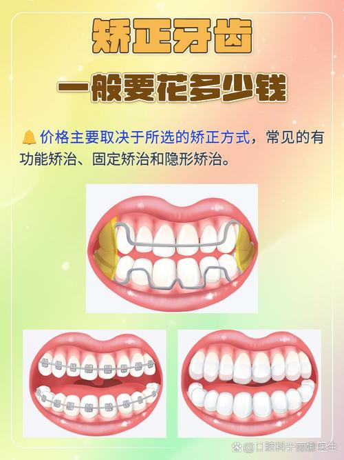 牙齿矫正要收难度费吗_牙齿矫正是不是要很多钱_14岁牙齿矫正一般需要多少钱