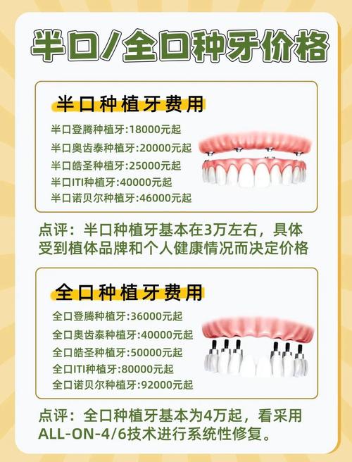 南京2026上海半口全口种植牙集采后多少钱