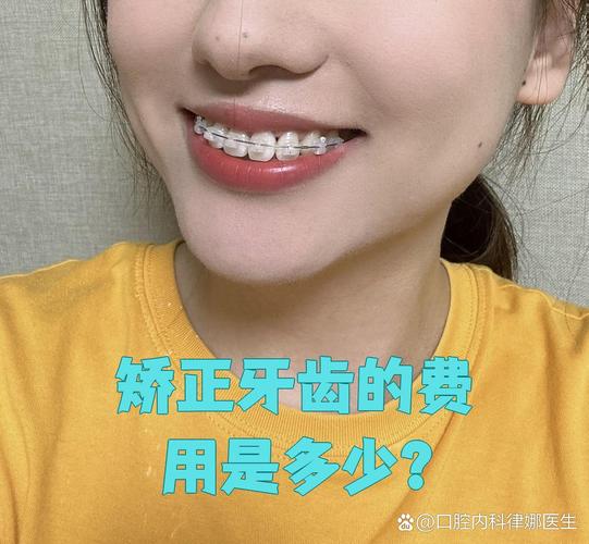 南京纠正牙型费用全解析:矫正牙齿一般要多少钱