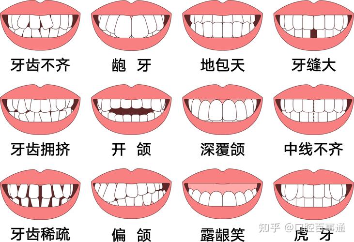 南京25岁矫正牙齿还来得及吗真实经历分享