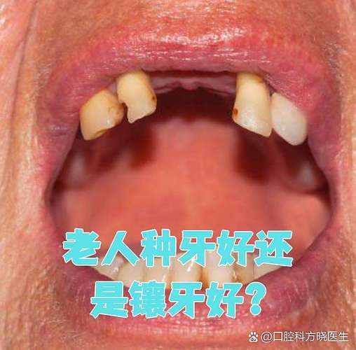 南京74岁老人种牙晚不晚？医生揭秘高龄种植的真实风险与收益