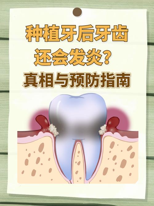 南京种植牙严重松动发炎，什么情况需要拔除？