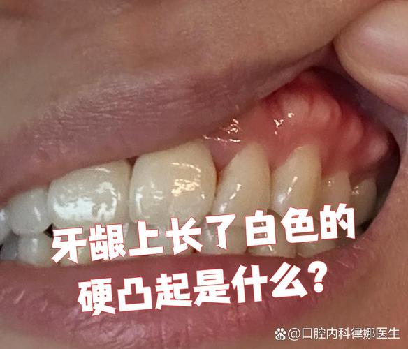 南京缺一颗牙一定要种吗 不种的后果你承受得起吗