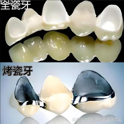 南京现在种一颗牙到底要花多少钱