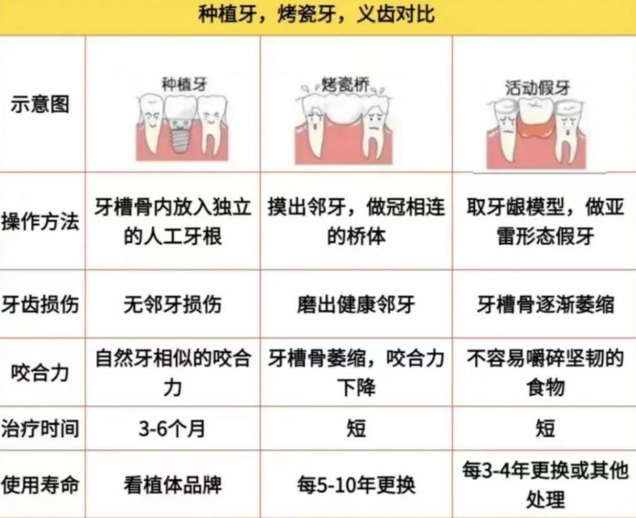 南京2万块种牙到底够不够 真实费用全解析