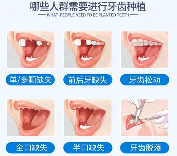 南京保定口腔医院收费多少钱？看牙项目全解析