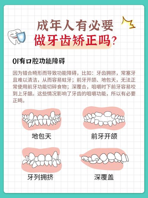 南京成年人牙齿矫正适合吗？30+做也不晚，先看这几点