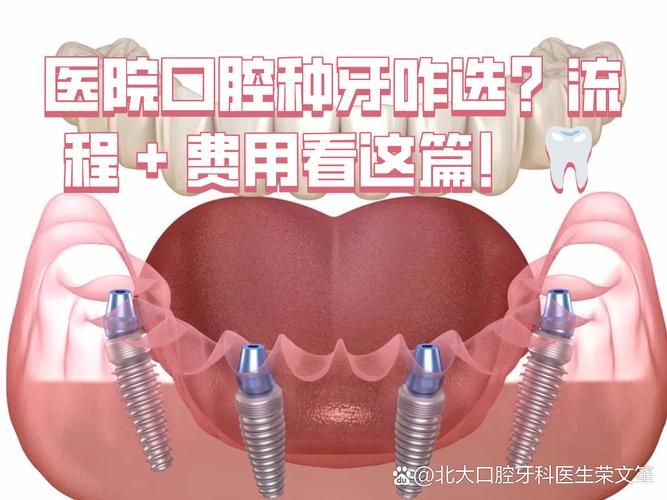 南京深圳连锁牙科种牙贵不贵？值不值得选？