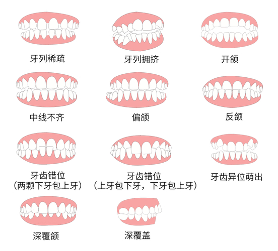南京30岁做牙齿矫正到底值不值 利与弊全分析
