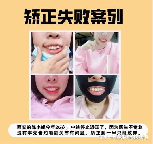 南京临沧牙齿矫正医院排名：这三家才是真靠谱