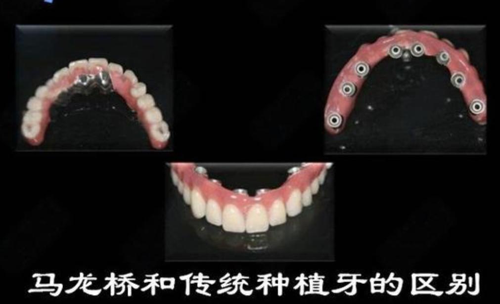 南京大同种牙哪里好 选公立还是私立更靠谱