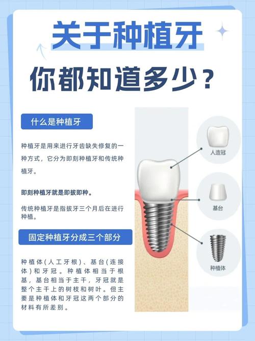 南京4颗牙一起种到底靠不靠谱 种植医生一次性讲清楚