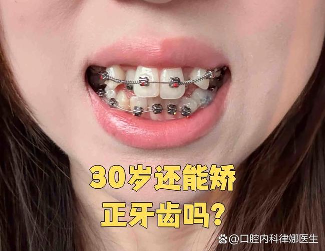 南京成年人也能做矫正 牙齿年龄限制真相大揭秘