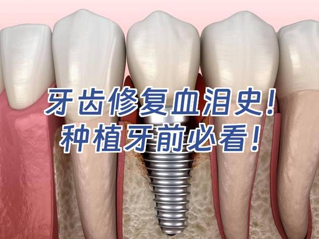 南京种植牙失败了怎么办 修复费用要多少才合理