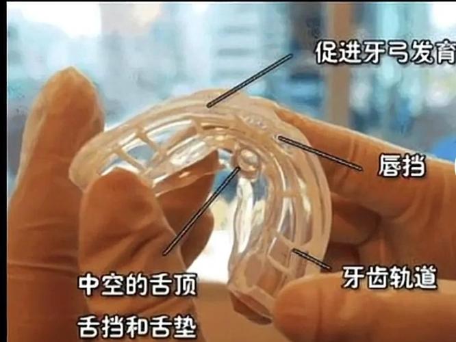 南京深圳南山儿童隐形MRC矫正费用到底多少钱？