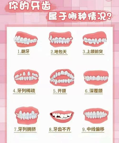 南京孩子几岁矫正牙齿最好 成人还能矫正吗