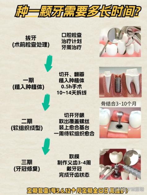 南京种牙前做CT是必须的吗 2026种牙CT检查费用全解析