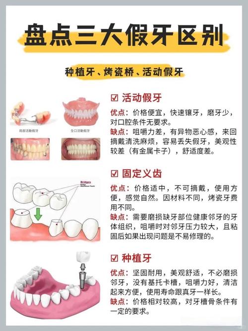 南京牙齿掉了是种牙还是镶牙 种牙过程和价格一文说清