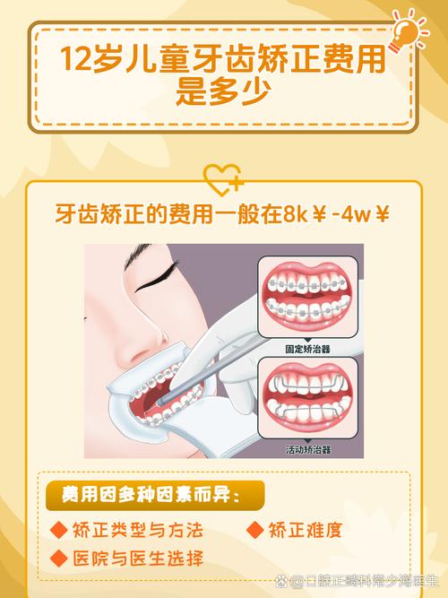 南京12岁矫正牙齿要多少钱？医生揭秘各阶段费用明细