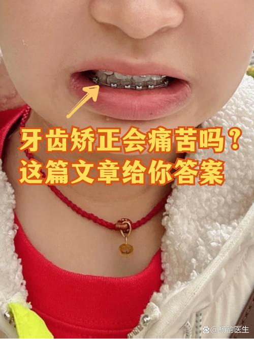 南京19岁做牙齿矫正晚不晚 过来人告诉你真实经历