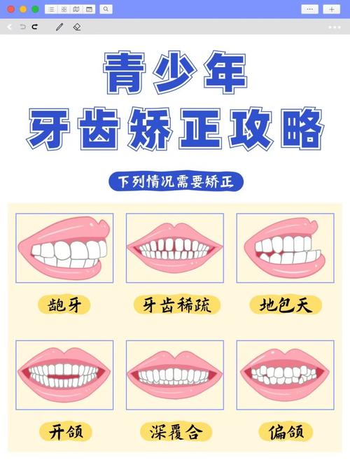 南京15岁牙齿不齐别慌!抓住矫正黄金期,这些方法快收藏