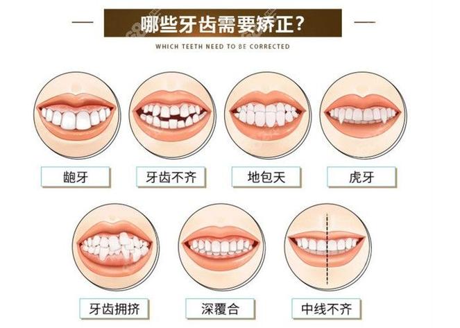 南京38岁矫正牙齿晚不晚 别让年龄成为你犹豫的借口