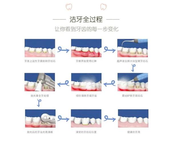南京深圳宝安隐适美正品认证医院怎么选？