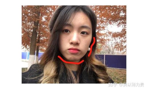 南京莲塘小孩正畸多少钱？费用明细和避坑指南
