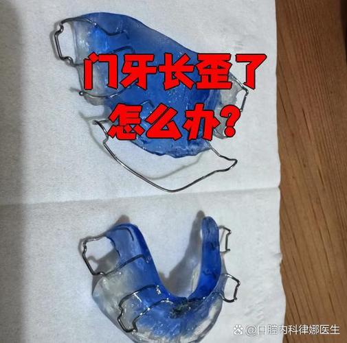 南京牙齿长歪了怎么矫正?多少钱能搞定?