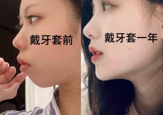 南京郴州做牙齿矫正哪家好?看完这篇不踩坑