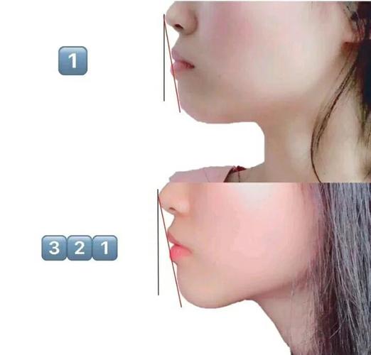 南京34岁做龅牙矫正还来得及吗?我的真实感受