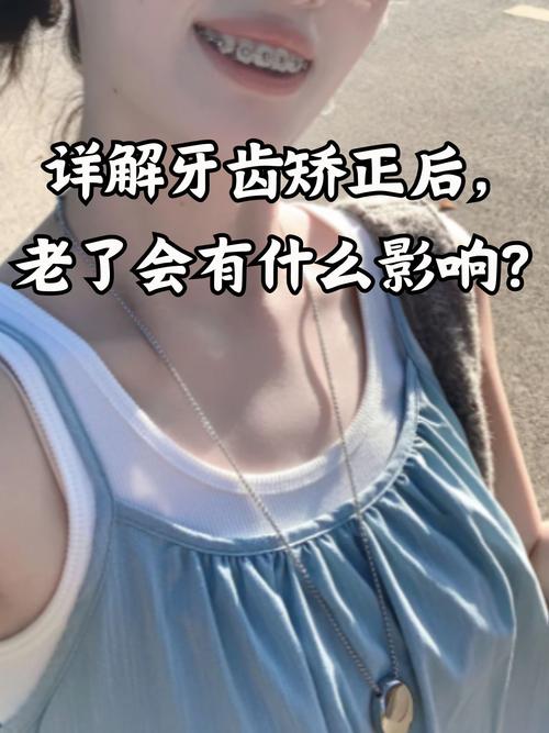 南京40岁还能矫正牙齿吗?看完这篇文章让你了解40岁牙齿矫正的真相