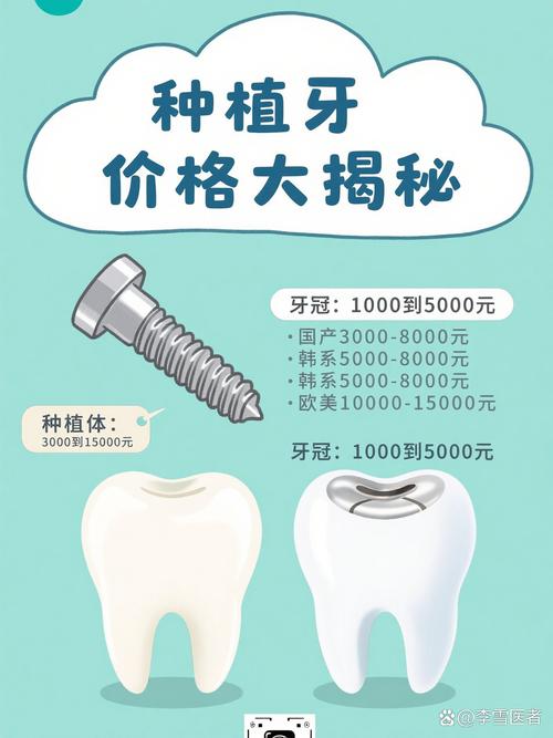 南京奥齿泰种牙贵不贵？一颗的价格究竟是多少？看完这篇就知道！