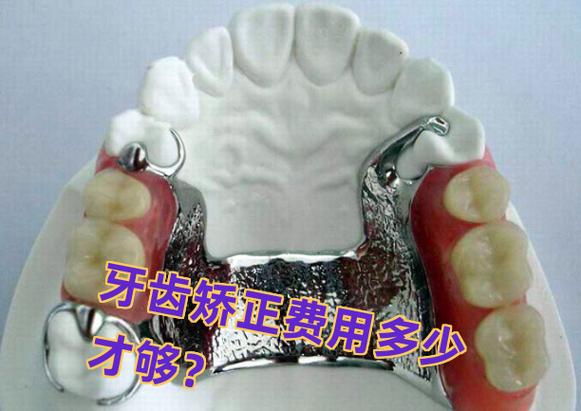 南京长沙矫正牙齿费用一览：从几千到几万差在哪