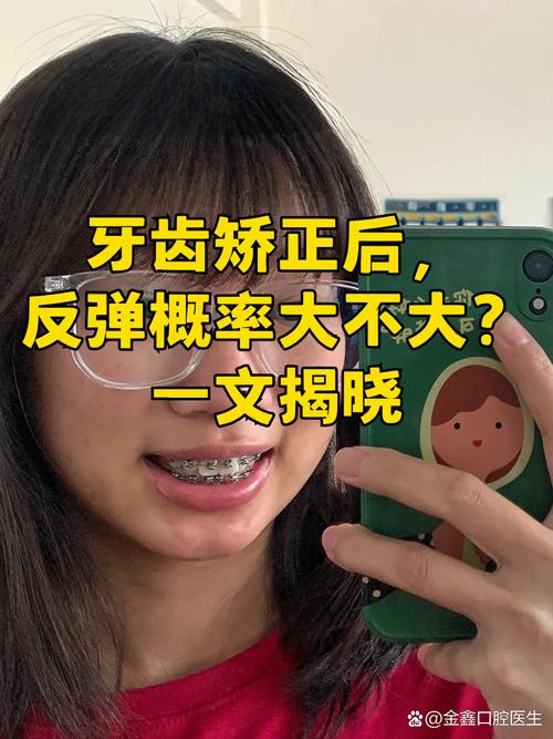 南京19岁做牙齿矫正晚不晚 过来人告诉你真实经历
