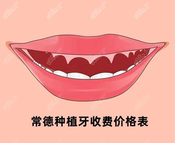 南京常德半口种植牙费用2026大概多少钱?真实价格参考